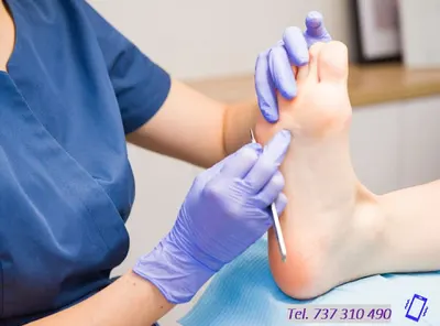 Gabinet Podologiczny Sanus Pes Podolog